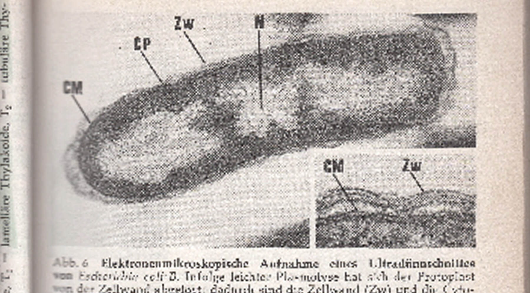 Widerstandsfähige Killerkeime und verdächtige biologische Strukturen – Infektionen verhüten